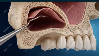 Dental Clinic Mira Clinic SAĞLIK TURİZM ŞİRKETİ