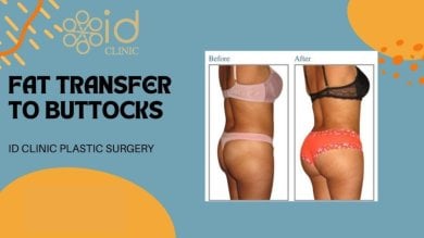 before-after photo vaser-liposuction