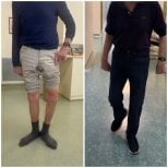 Vorher-nachher-Ergebnisse der Knieoperation in der Dr Andreas Papadopoulos Sports Medicine Klinik