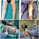 Ablauf und Ergebnisse der Knieprothese in der Dr Andreas Papadopoulos Klinik