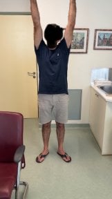 Покращена рухливість плеча після відновлення ротаторної манжети у доктора Пападопулоса