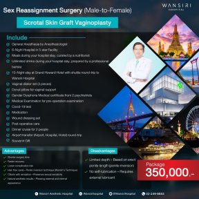 before-after photo sex-reassignment-surgery
