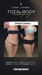 Before and after post-bariatric plastic surgery results at Memorial Şişli Hospital, body contouring