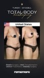 Before and after post-bariatric plastic surgery results at Memorial Şişli Hospital, body contouring