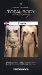 Before and after post-bariatric plastic surgery results at Memorial Şişli Hospital, body contouring