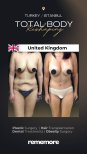 Before and after post-bariatric plastic surgery results at Memorial Şişli Hospital, body contouring