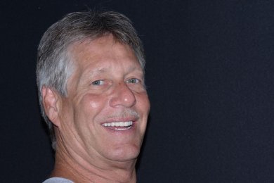 before-after photo all-on-6-dental-implants