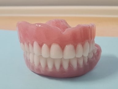 Resultado de implante dental en SoftDentalCare Clinic: dentadura completa de aspecto natural