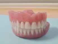Resultado de implante dental en SoftDentalCare Clinic: dentadura completa de aspecto natural
