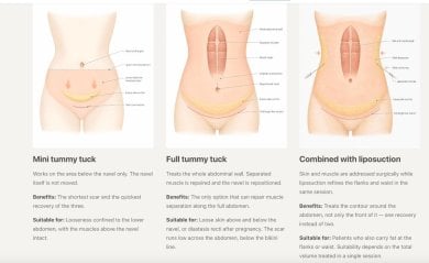 before-after photo abdominoplasty