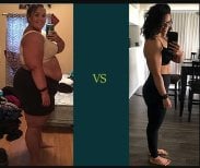 Before and after gastric sleeve surgery results at NOVİN ARİANA SAĞLIK VE TURİZM LİMİTED ŞİRKETİ