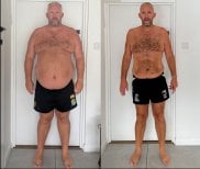 Before and after gastric sleeve surgery results at NOVİN ARİANA SAĞLIK, visible weight loss