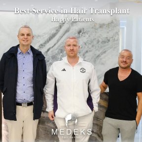 before-after photo fue-hair-transplant