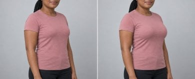 before-after photo breast-augmentation