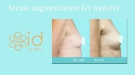 Результаты до и после увеличения груди липофилингом в ID Clinic Bangkok