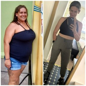 before-after photo sleeve-resection