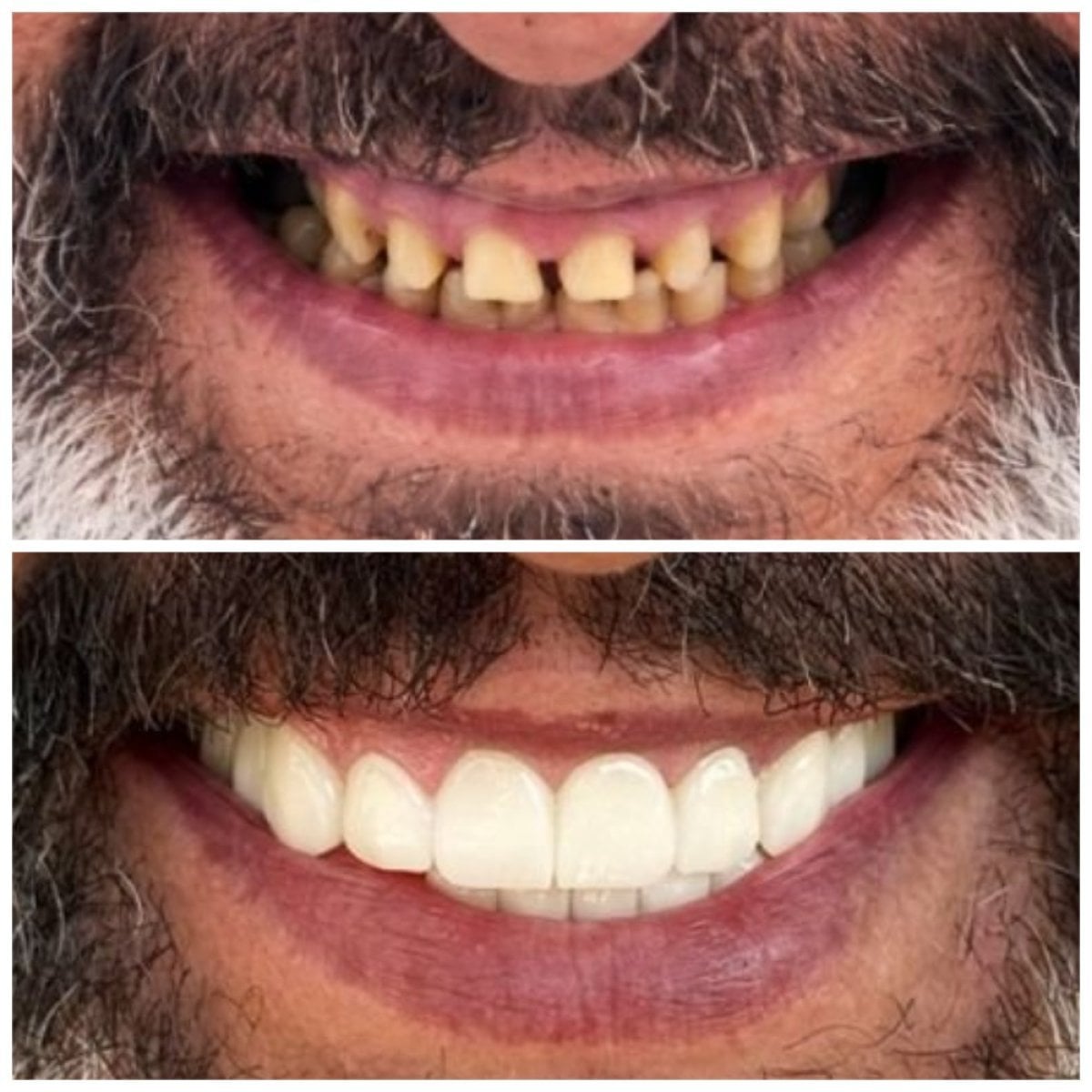 before-after photo