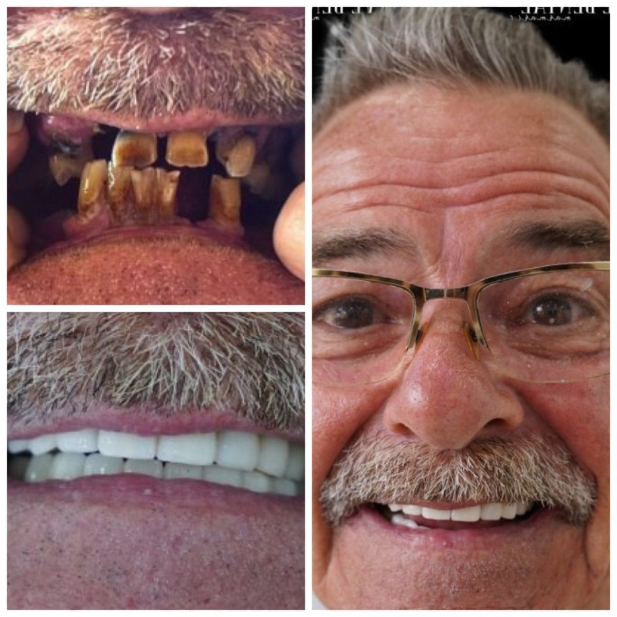 before-after photo