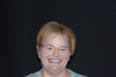 before-after photo all-on-4-dental-implants