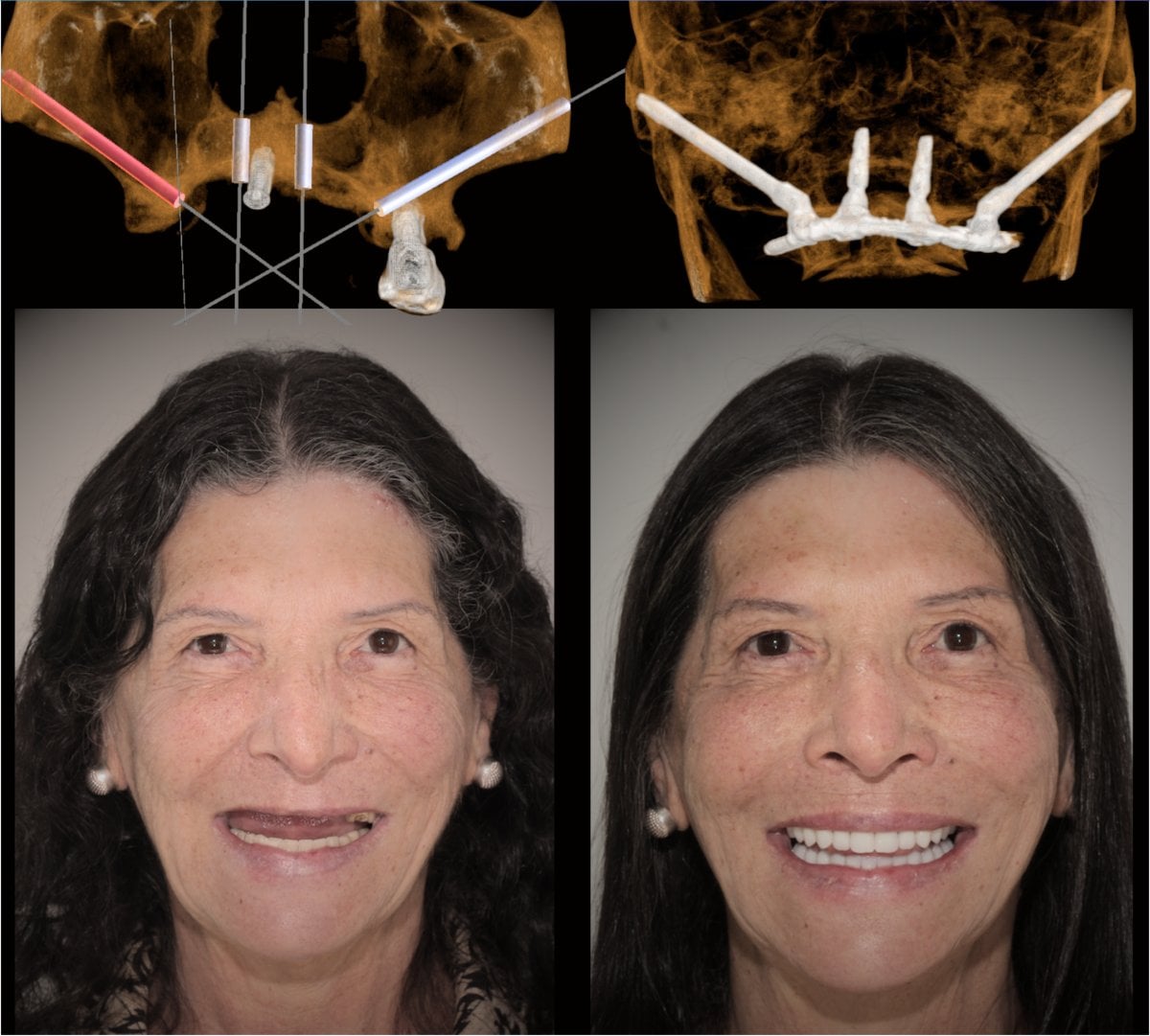 before-after photo