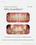 Before and after braces results at Guardians Dental Clinic – improved teeth alignment