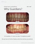 Before and after braces results at Guardians Dental Clinic – improved teeth alignment