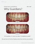 Before and after braces results at Guardians Dental Clinic – straighter teeth and improved smile