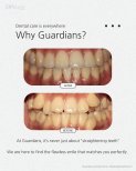Before and after braces results at Guardians Dental Clinic – straighter teeth and improved smile