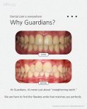 Before and after braces results at Guardians Dental Clinic – improved teeth alignment