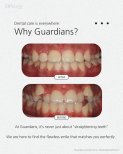 Before and after braces results at Guardians Dental Clinic – improved teeth alignment