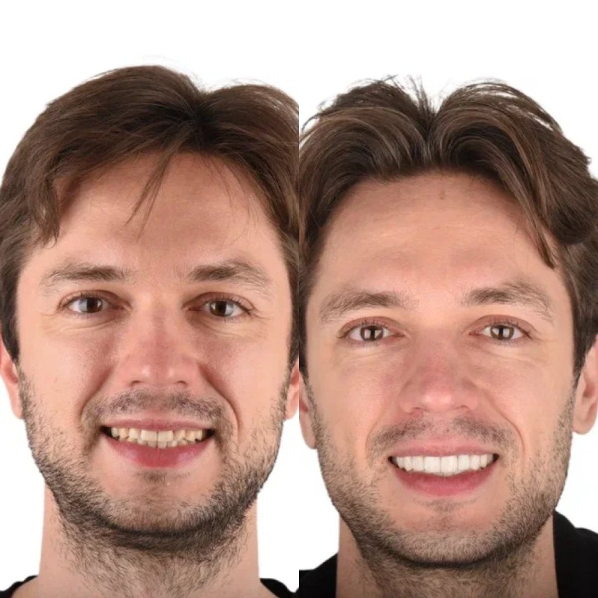 before-after photo