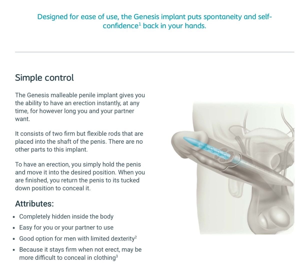 Diagrama del implante de pene Genesis en Menness Wellness Clinic con varillas maleables