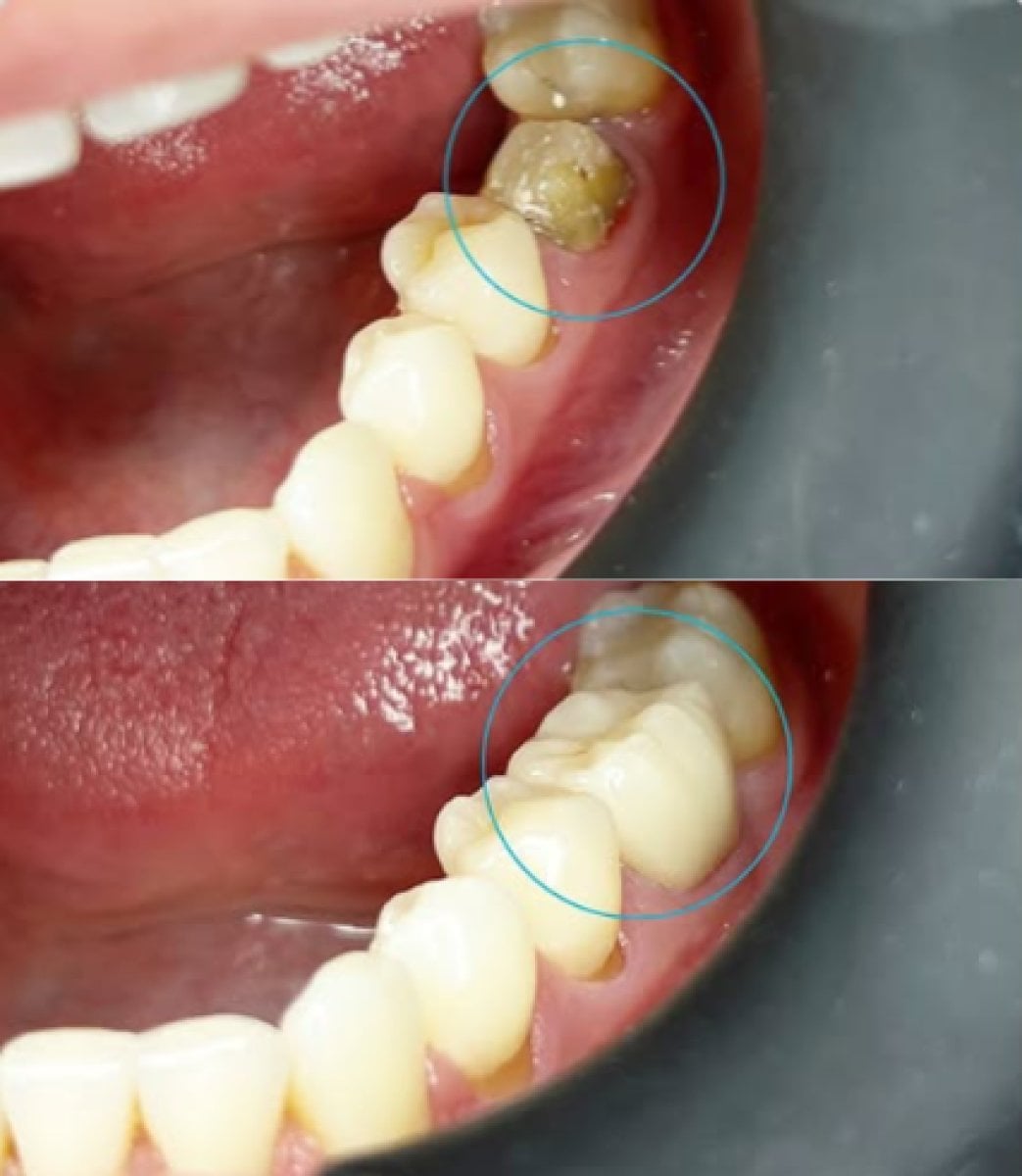 before-after photo