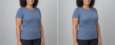 before-after photo breast-augmentation