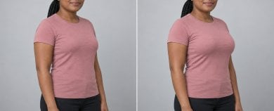before-after photo breast-augmentation
