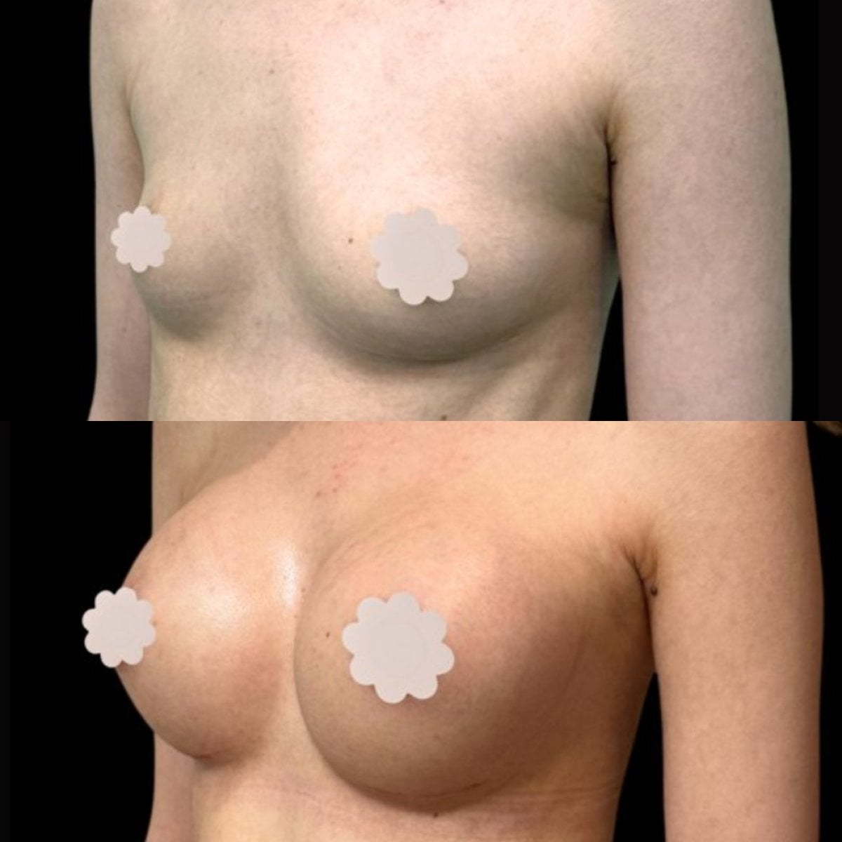 before-after photo