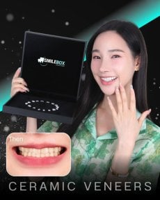 نتائج قبل وبعد فينير إيماكس في SmileBox Dental Clinic - Thonglor, Sukhumvit
