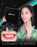 نتائج قبل وبعد فينير إيماكس في SmileBox Dental Clinic - Thonglor, Sukhumvit