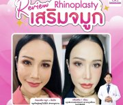 Resultados de rinoplastia antes y después en Somchai Clinic, remodelación nasal refinada