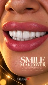 before-after photo installation-of-a-veneer