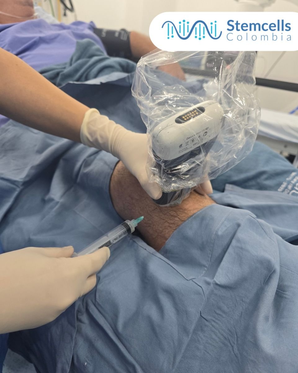Fotos de antes y después de Tratamiento de la diabetes mellitus con células madre tomadas por el Dr.(la Dra.) 