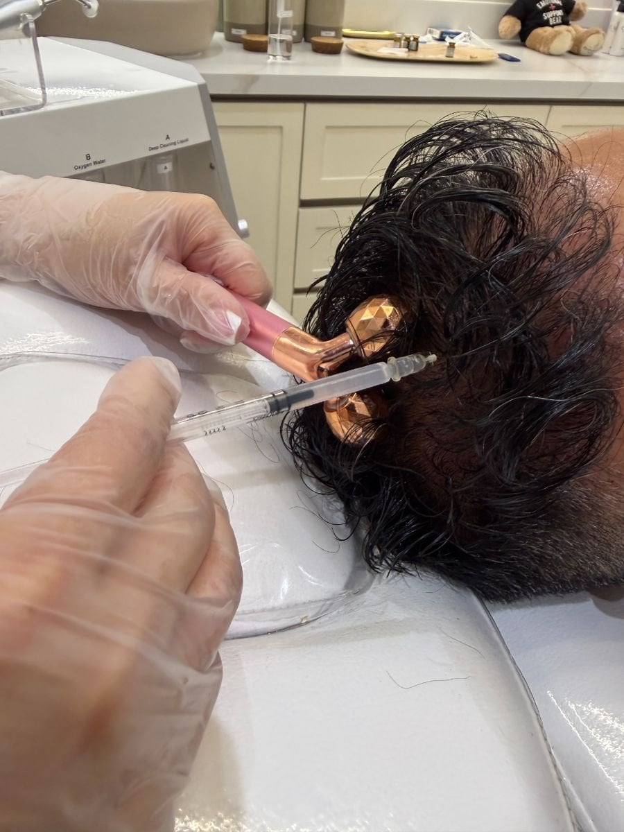 Fotos de antes y después de Tratamiento de la diabetes mellitus con células madre tomadas por el Dr.(la Dra.) 