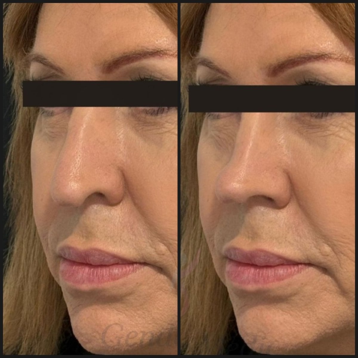 before-after photo