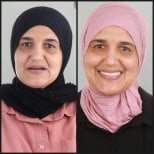 نتيجة قبل وبعد زراعة الأسنان All-on-4 في عيادة Dentaray، استعادة الابتسامة