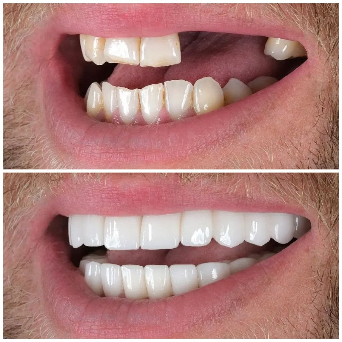 before-after photo