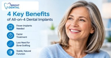 before-after photo all-on-4-dental-implants