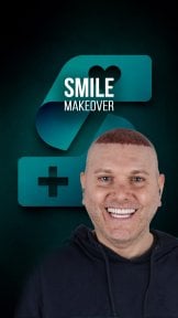 before-after photo smile-makeover