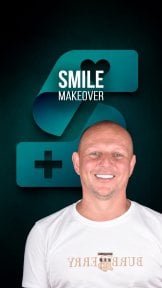 before-after photo smile-makeover