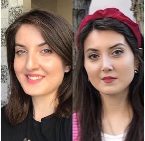 before-after photo rhinoplasty-nose-job