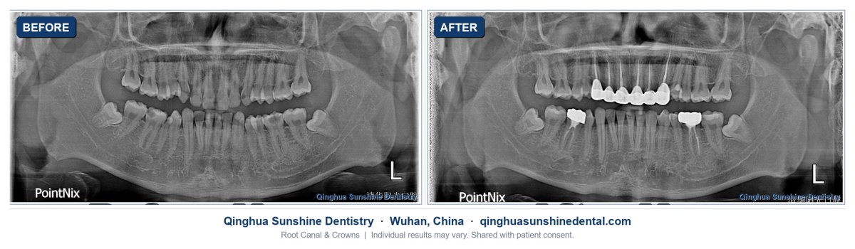 before-after photo